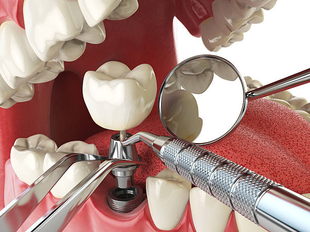 Best Broken or Chipped Tooth Repair in Las Quintas Fronterizas, TX